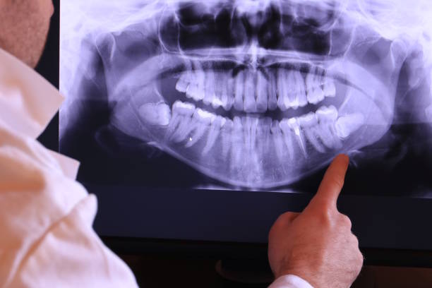 Best Weekend Emergency Dentist in Thornton, CO