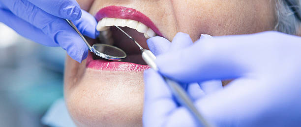 Best Emergency Dental Care for Broken or Chipped Teeth in Thornton, CO